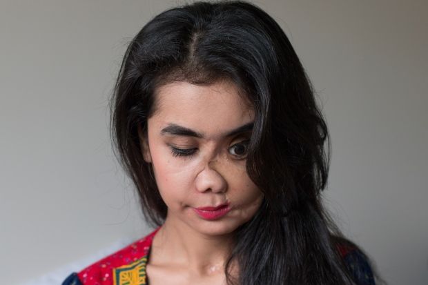 Shot in the face by her husband in Afghanistan, former teen bride Shakila Zareen starts anew in Canada: https://t.co/TTNJKCmge3

"I thought that I was dreaming. I just remember begging my mom to wake me because I was in so much pain and I wanted the dream to be over." 