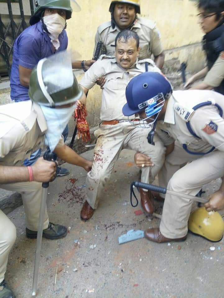 It pains to see this and brings to fore perils and tough situations that police face. 

Asansol-Durgapur DCP &amp; IPS officer Arindam Dutta Chowdhury was severely injured &amp; lost his hand in abhorring violence on Monday. We pray for his speedy recovery and full restoration of hand. 
