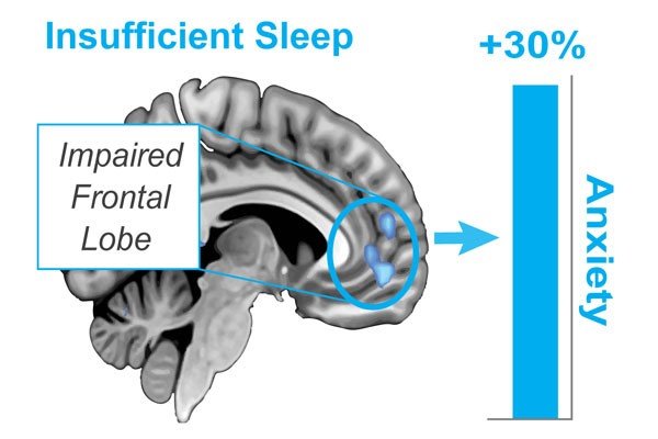 Our new findings reveal a novel role for deep (NREM) sleep in rewiring and calming the anxious brain. Fantastic work by research fellow, @etoosh. https://t.co/lNeTzHjjOR  https://t.co/Z34ZRWCHe8 