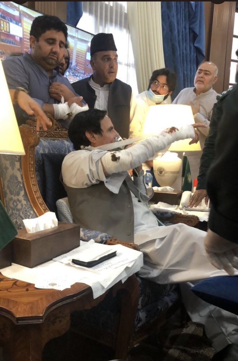 یہ ٹوٹا بازو اوپر کیسے اٹھایا جاسکتا ہے ؟ اگر کوئی آرتھوپیڈک سرجن سمجھا سکے تو مہربانی ہوگی 