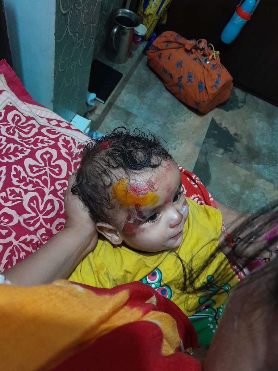 उत्तर प्रदेश-

लखनऊ में बाइक सवार लुटेरों का आतंक है,लगातार महिलाओं के साथ चेन स्नेचिंग की घटनायें हो रहीं हैं,कल अलीगंज में बाइक सवार बदमाशों ने बाइक से जा रहे दंपत्ति से पर्स छीनने की कोशिश की,इस दौरान बाइक गिरने से दंपत्ति के साथ उनके मासूम बच्चे को भी चोटें आईं !!

हाल ही में 