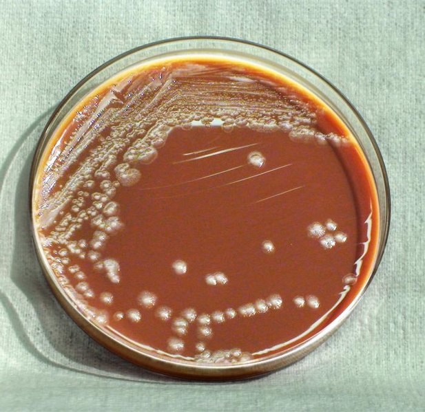 It's time for #MicrobeoftheMonth! Who am I?

1) I’m a zoonotic pathogen. 
2) I am nonmotile.
3) I have caused 3 DNA-verified pandemics during recorded history. 

Think you know? Leave a guess below! 