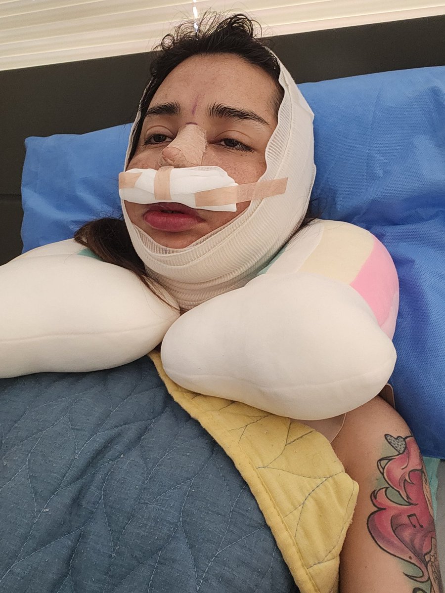 Abro denuncia de como intente ayudar a @samyriveratv a entrenar y me dejo así. 