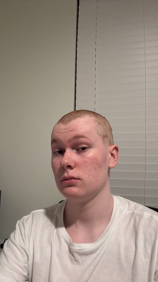 They can no longer call me chopped 