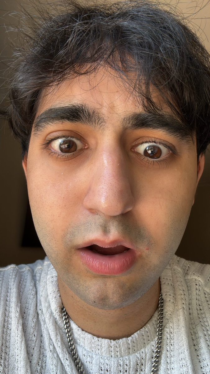 WAHT THE FUCKKKKKK 