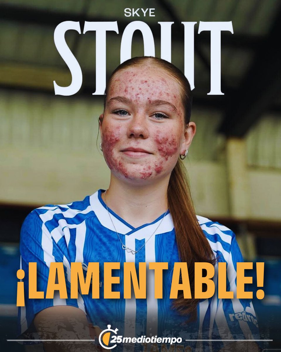 INACEPTABLE SITUACIÓN 💔

Skye Stout, jugadora escocesa, acababa de firmar su primer contrato como profesional con el Kilmarnock con tan solo 16 años, en lo que debería haber sido uno de los mejores días de su vida. Lamentablemente, luego de que el equipo anunciara el fichaje en 