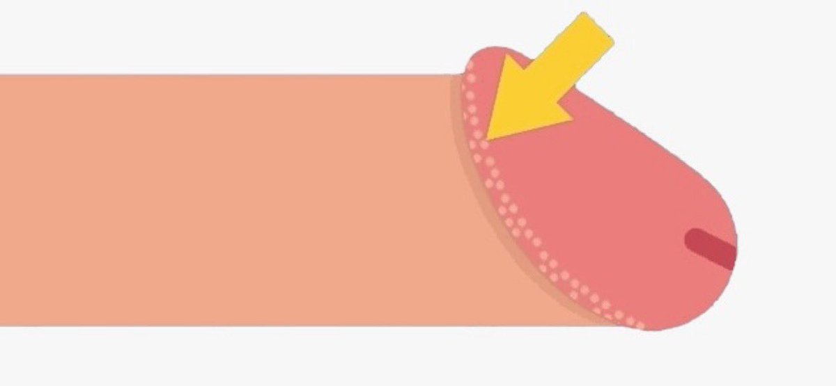 HORA DA BIOLOGIA CARALHO!!

Você ja deve ter se perguntado o que caralhos são essas bolinhas debaixo da cabeça do pau, afinal, é uma doença venérea, algo normal, um choquito de piroca?pode ficar calmo que não é IST (até pq tu não transa), senta ai que eu explico 