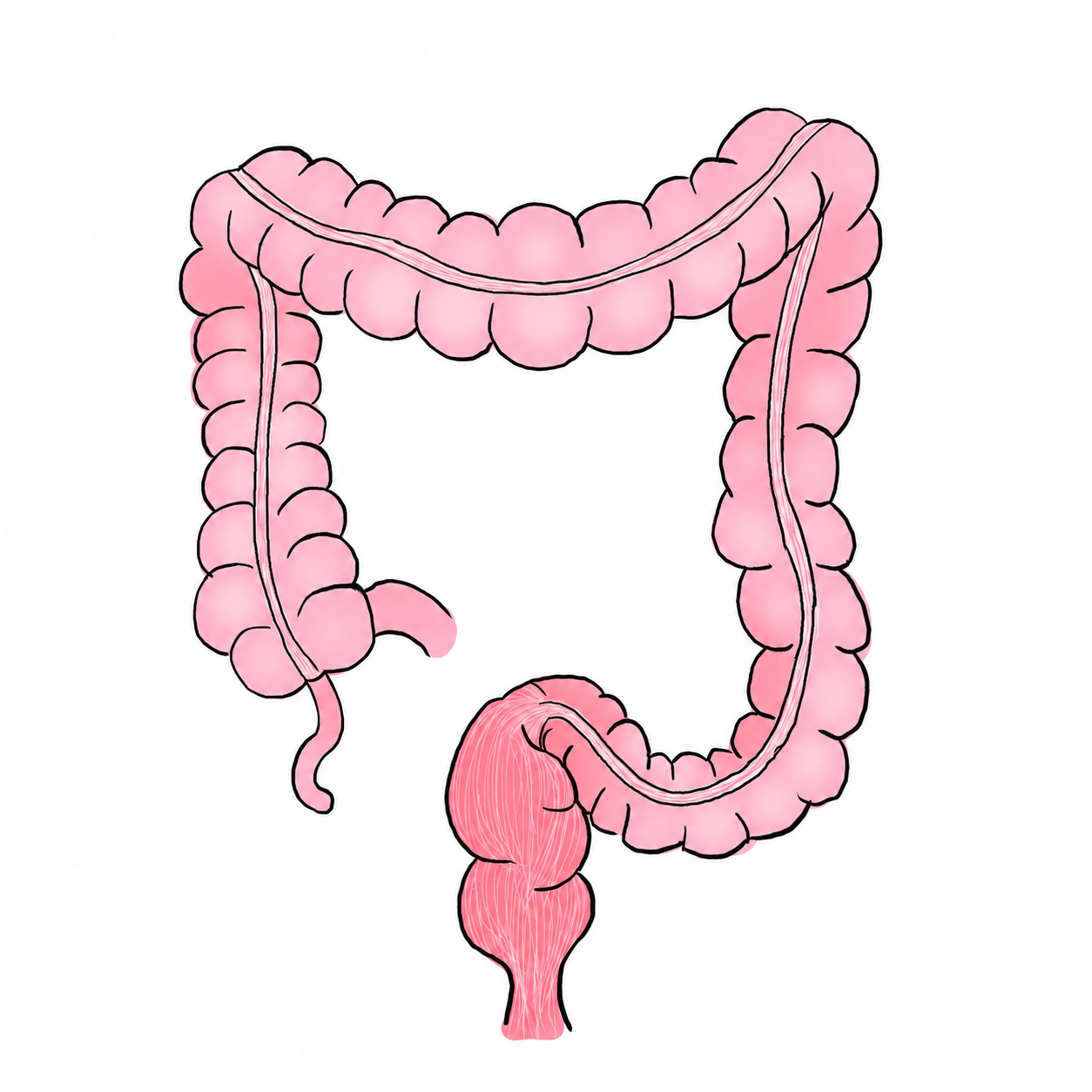 446. Surgical Management of Colorectal Cancer – Part 1 NOTES