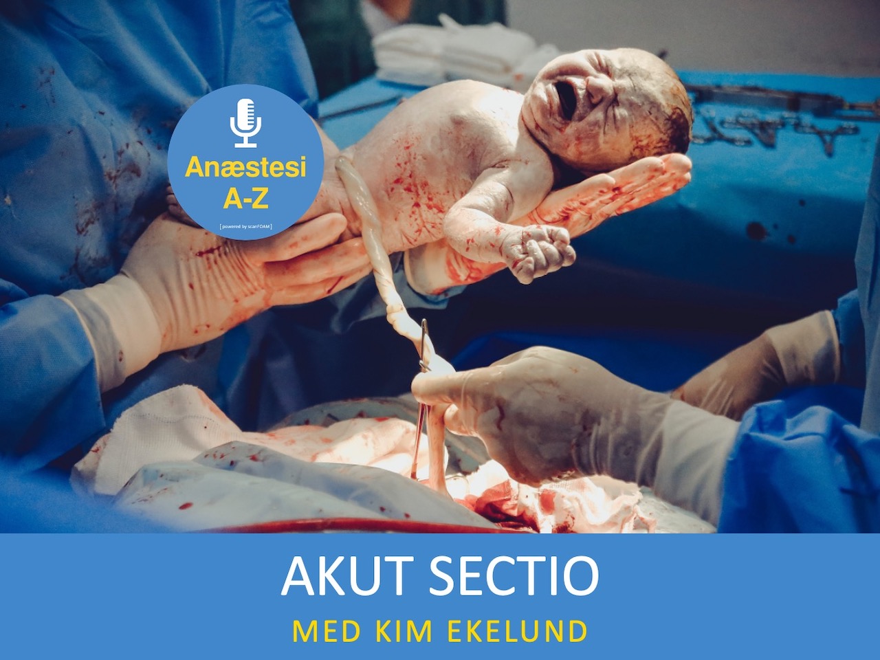 Anæstesi A-Z ep. 12 | Akut sectio